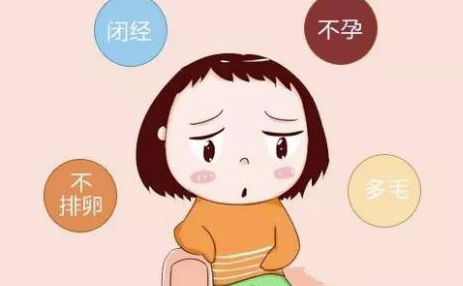 多囊卵巢综合症1.png