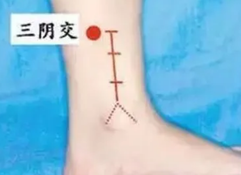 阴交穴调理月经推迟有一定的疗效