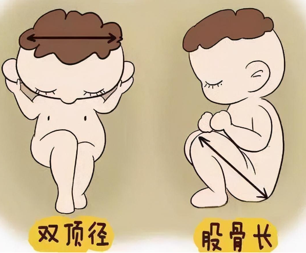 双顶径是胎儿头部横向直径