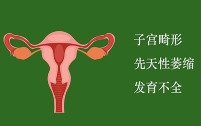 b5515a59f624341bf752027964f2d7478a902.png