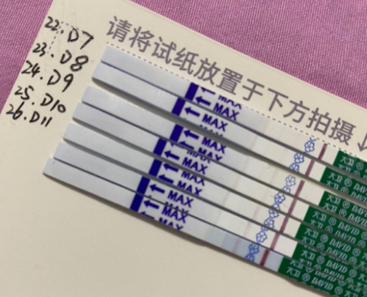 囊胚移植10天左右验孕