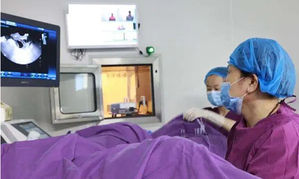 取卵后3天没腹水不安全
