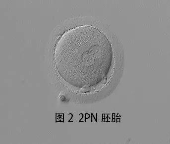 受精卵1pn和2pn的区别