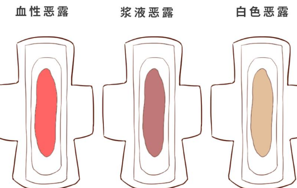 产后19天恶露褐色可能正常