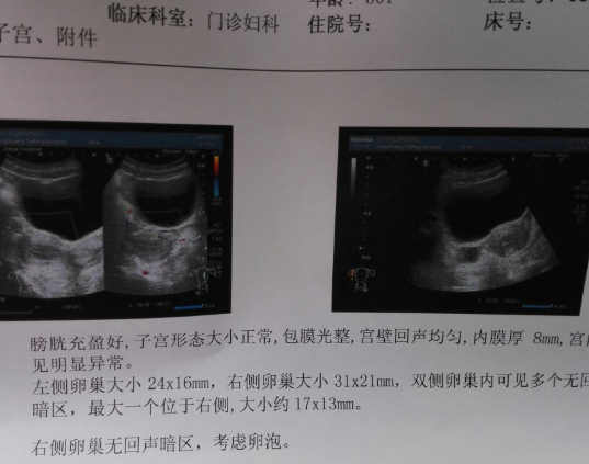 卵泡发育成熟要2周左右