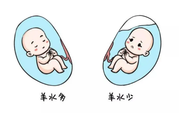 羊水多少是胎儿性别暗示
