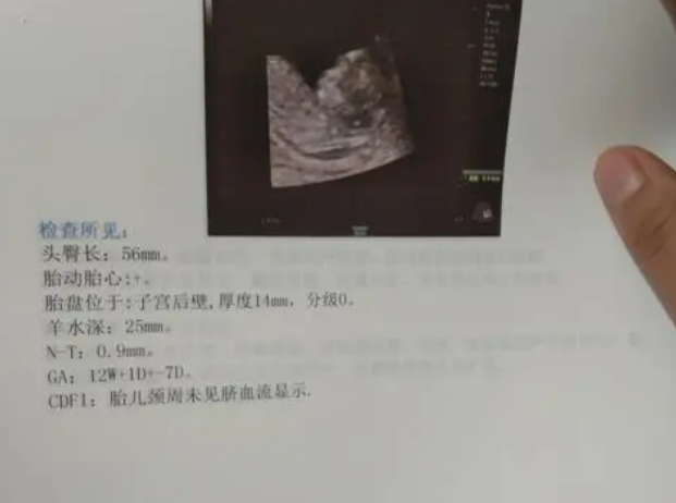 nt检查不达标的人不多