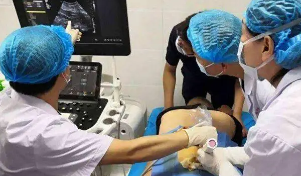 羊水穿刺报告单图片
