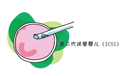 JOKNSEL_~IVS_HRKY48SJ5H.png
