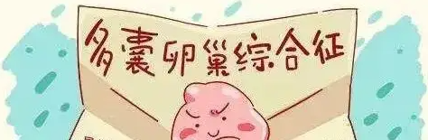 多囊卵巢综合症.png