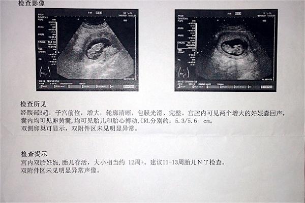 彩超单不能看宝宝男女