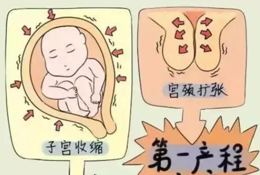初产妇开十指宫口时间不固定