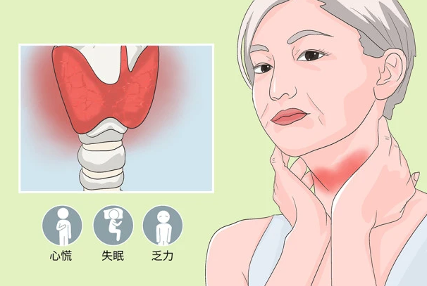 一般公司体检不做甲状腺检查