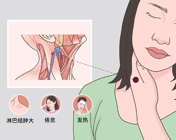淋巴结肿瘤是恶性疾病