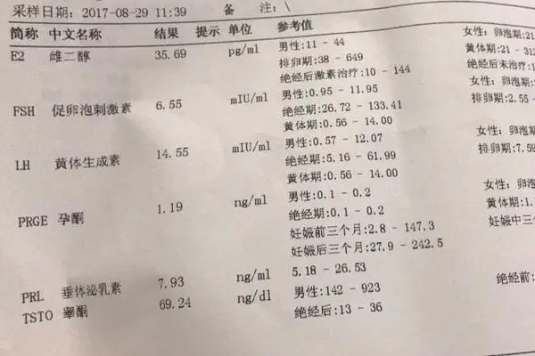 激素五项可监测治疗进程