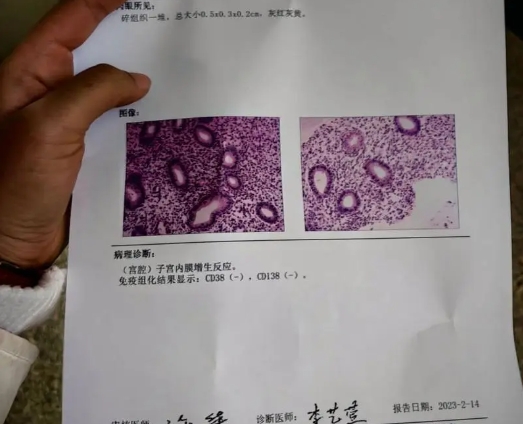 结果阴性不能决定移植与否