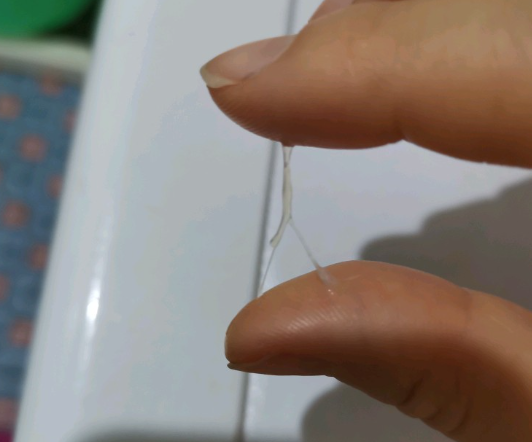 孕期白带会增多