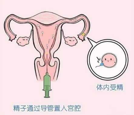 授精失败会没有反应