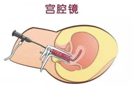 宫腔镜没休息好的危害大吗，会有哪些危害